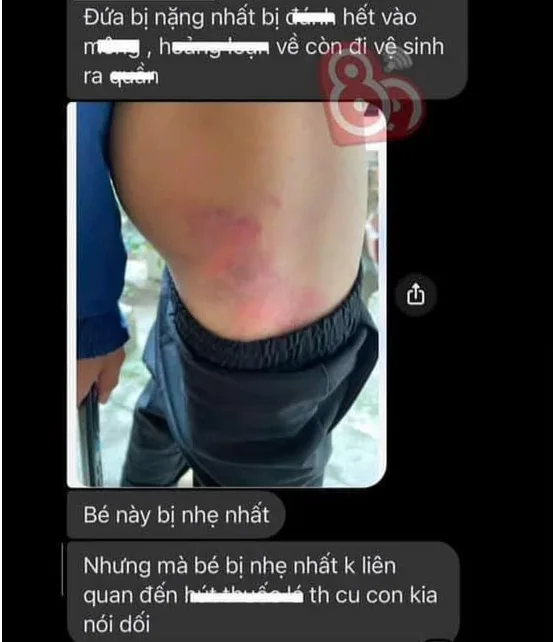 Hưng Yên: Các cháu sai thì dạy dỗ ră:n đ:e thôi được rồi, chứ lại đ::ánh ra nô:ng n:ỗi nà:y